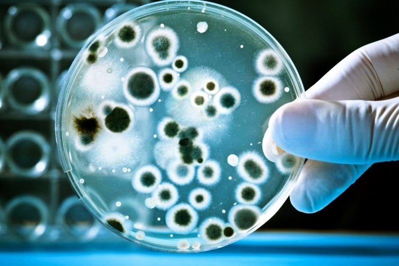 उपत्यकाका २३ दूध डेरीमा भेटियो हानिकारक जीवाणु 