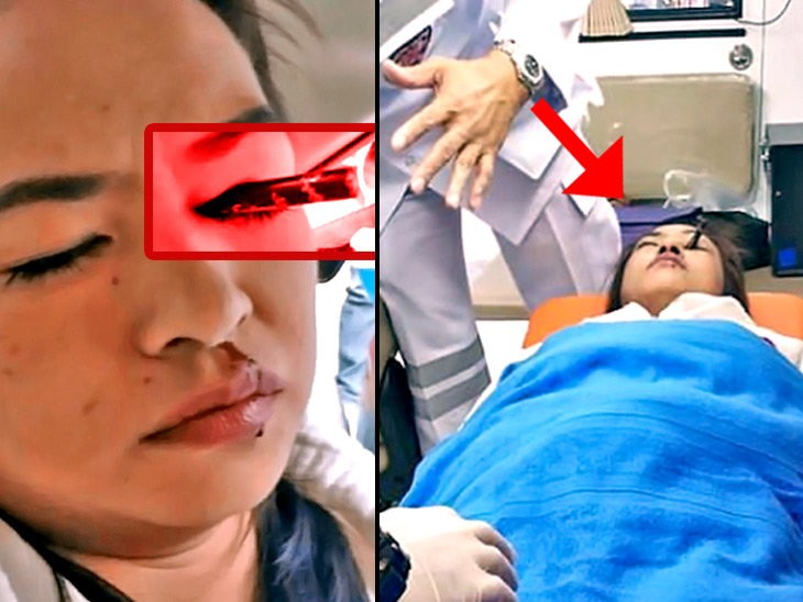गुडिरहेको कारमा मेकअप गर्दा महिलाको आँखाभित्र छिर्यो आइब्रो पेन्सिल