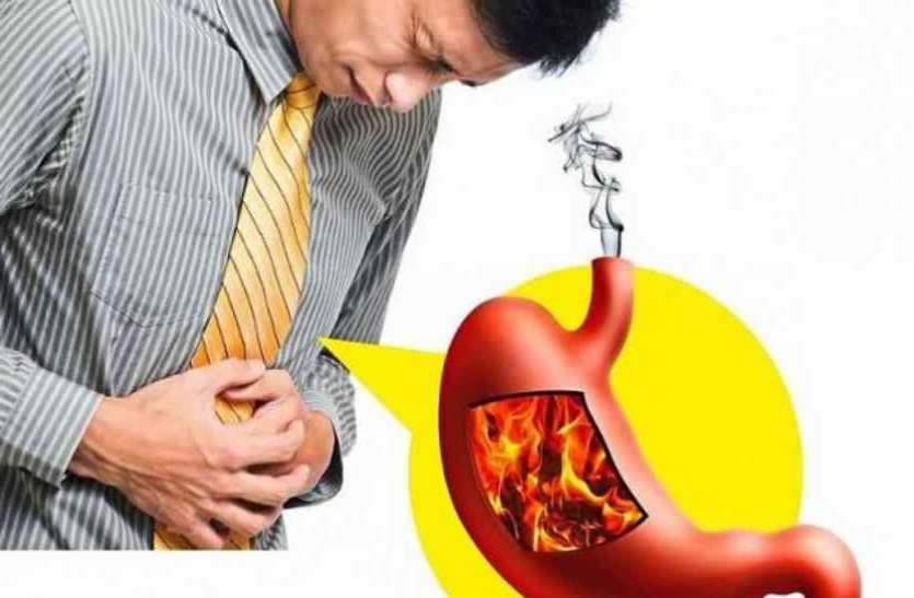 यस्तो छ एसिडिटीकोे घरेलु उपचार
