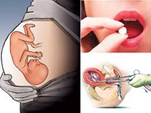 औषधीको प्रयोगबाट गरिने सुरक्षित गर्भपतन कसरी गरिन्छ ?